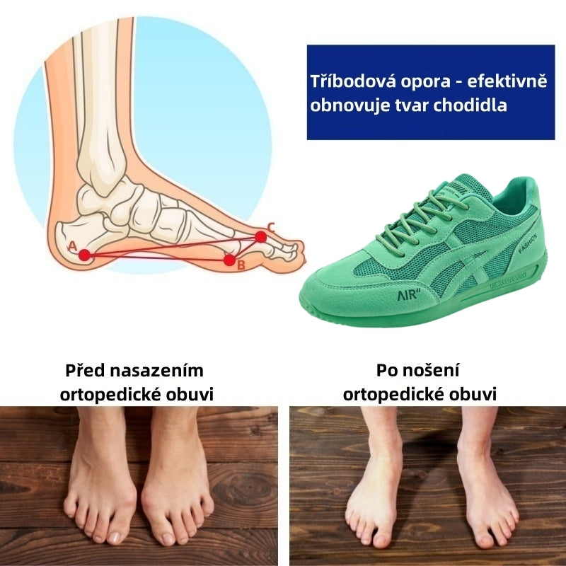 Ortopedická obuv SHELLSEN® 【🔥 Novinka za poloviční cenu🎁】| Ergonomický design | Ulevuje od bolesti zad, kloubů a chodidel | Vynikající odpružení a korekce chůze（副本）