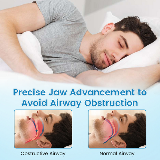 😴 Flanora Anti-Snoring Device: Reduce Snoring From First Night! ✨