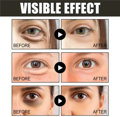 👀 Koffein Retinol Szemkrém: 50% Akció! Puffiness + Sötét Körök Eltávolítása! ✨