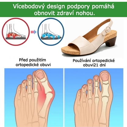 Ortopedické boty SHELLSEN® 【🔥50% sleva dnes🎁】 Pohodlné sandály, jeden pár pro všechny vaše potřeby: každodenní dojíždění, rande, nakupování - protiskluzová podrážka - Pravost zaručena