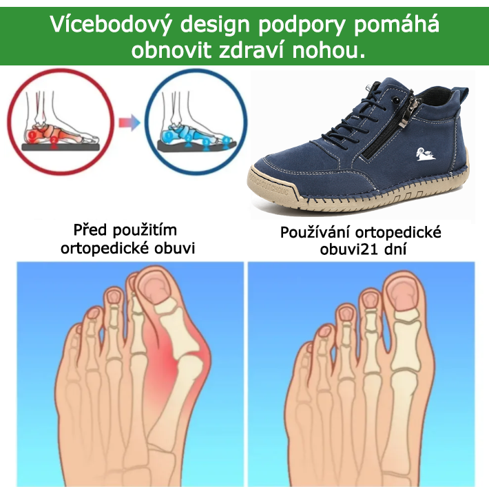🔥 Dnes sleva 50 % – nenechte si to ujít! ⏰ Ortopedické semišové boty od luxusní australské značky: měkké a pohodlné, poskytující vynikající oporu chodidla a účinnou úlevu od bolesti.