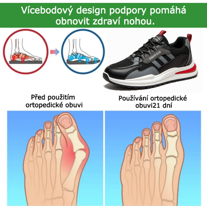 SHELLSEN® 【🔥Dnešní speciální nabídka: sleva 50 %🎁】Pohodlná vycházková obuv | Lehká a odolná👟 | Žádná únava z celodenní chůze | Podpora klenby | Účinně zmírňuje problémy s chodidly✅