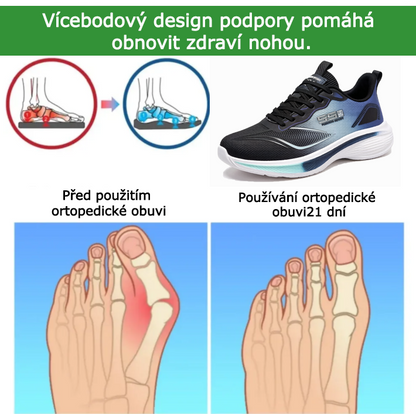 SHELLSEN® 【🔥Dnešní speciální nabídka: sleva 50 %🎁】Pohodlná vycházková obuv | Lehká a odolná👟 | Žádná únava z celodenní chůze | Podpora klenby | Účinně zmírňuje problémy s chodidly✅