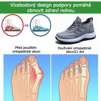 Ortopedická obuv SHELLSEN® 【🔥 Novinka za poloviční cenu🎁】| Ergonomický design | Ulevuje od bolesti zad, kloubů a chodidel | Vynikající odpružení a korekce chůze