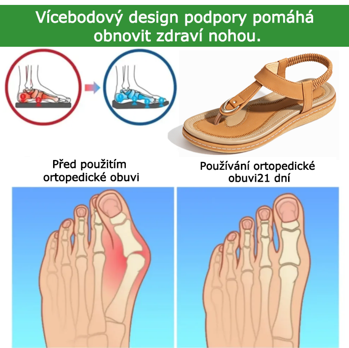 Ortopedické boty SHELLSEN® 【🔥Dnes sleva 50 %🎁】 Nejžhavější letní sandály v Evropě👡 | Pohodlná a bezbolestná chůze | Design s oporou klenby | Perfektní volba pro letní výlety✅