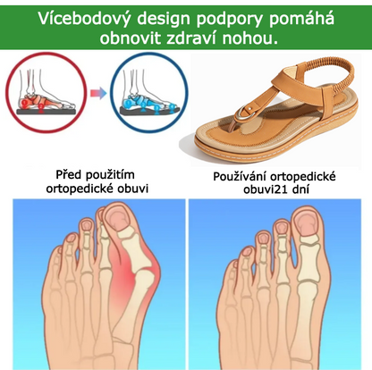 Ortopedické boty SHELLSEN® 【🔥Dnes sleva 50 %🎁】 Nejžhavější letní sandály v Evropě👡 | Pohodlná a bezbolestná chůze | Design s oporou klenby | Perfektní volba pro letní výlety✅