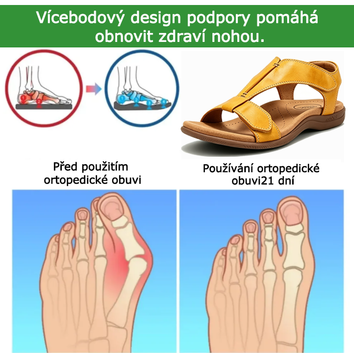 Ortopedické boty SHELLSEN® [🔥Dnes sleva 50 %🎁] Nejžhavější letní sandály v Evropě👡 | Pohodlná a bezbolestná chůze | Design s oporou klenby | Perfektní volba pro letní výlety✅
