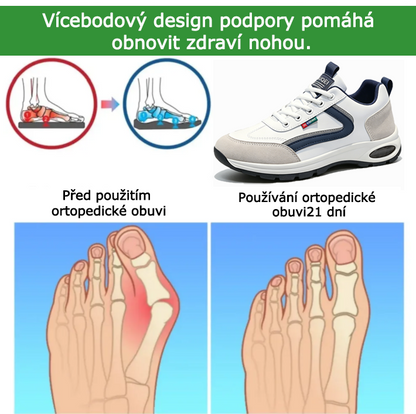 Ortopedická obuv SHELLSEN® [🔥Novinka za poloviční cenu🎁] Pohodlná sportovní obuv | Prodyšná a chladivá | Design s podporou klenby | Ulevuje od bolesti zad a chodidel✅