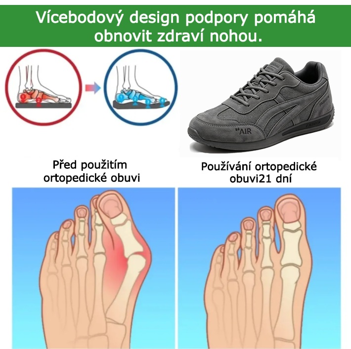 Ortopedická obuv SHELLSEN® 【🔥 Novinka za poloviční cenu🎁】| Ergonomický design | Ulevuje od bolesti zad, kloubů a chodidel | Vynikající odpružení a korekce chůze