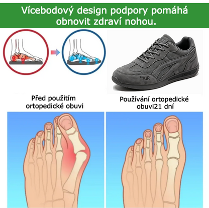Ortopedická obuv SHELLSEN® 【🔥 Novinka za poloviční cenu🎁】| Ergonomický design | Ulevuje od bolesti zad, kloubů a chodidel | Vynikající odpružení a korekce chůze