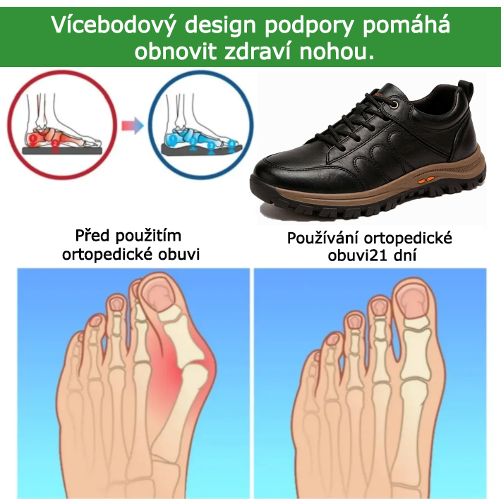 SHELLSEN® 【🔥Dnešní speciální nabídka: sleva 50 %🎁】Pohodlná vycházková obuv | Lehká a odolná👟 | Žádná únava z celodenní chůze | Podpora klenby | Účinně zmírňuje problémy s chodidly✅