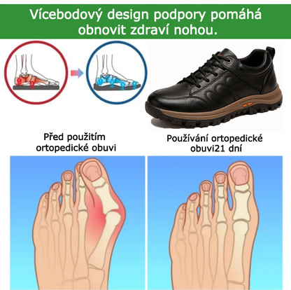 SHELLSEN® 【🔥Dnešní speciální nabídka: sleva 50 %🎁】Pohodlná vycházková obuv | Lehká a odolná👟 | Žádná únava z celodenní chůze | Podpora klenby | Účinně zmírňuje problémy s chodidly✅