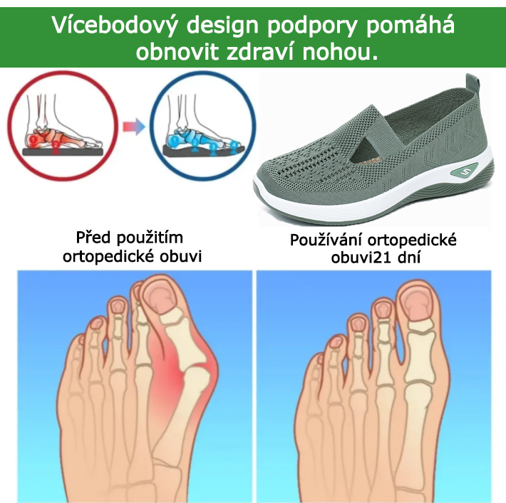 Ortopedická obuv SHELLSEN® [🔥50% sleva🎁] Pohodlná vycházková obuv | Prodyšný design | Chladivá a prodyšná | Zlepšuje tvar nohou | Ulevuje od bolesti nohou ✅