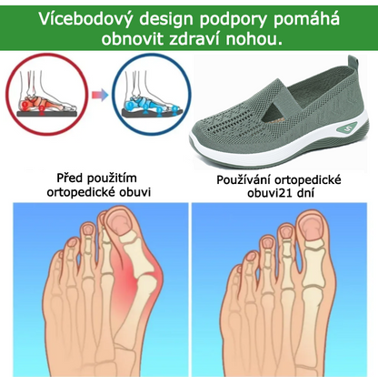 Ortopedická obuv SHELLSEN® [🔥50% sleva🎁] Pohodlná vycházková obuv | Prodyšný design | Chladivá a prodyšná | Zlepšuje tvar nohou | Ulevuje od bolesti nohou ✅