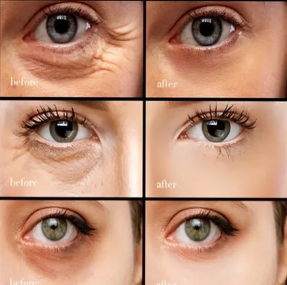 👀 Koffein Retinol Szemkrém: 50% Akció! Puffiness + Sötét Körök Eltávolítása! ✨